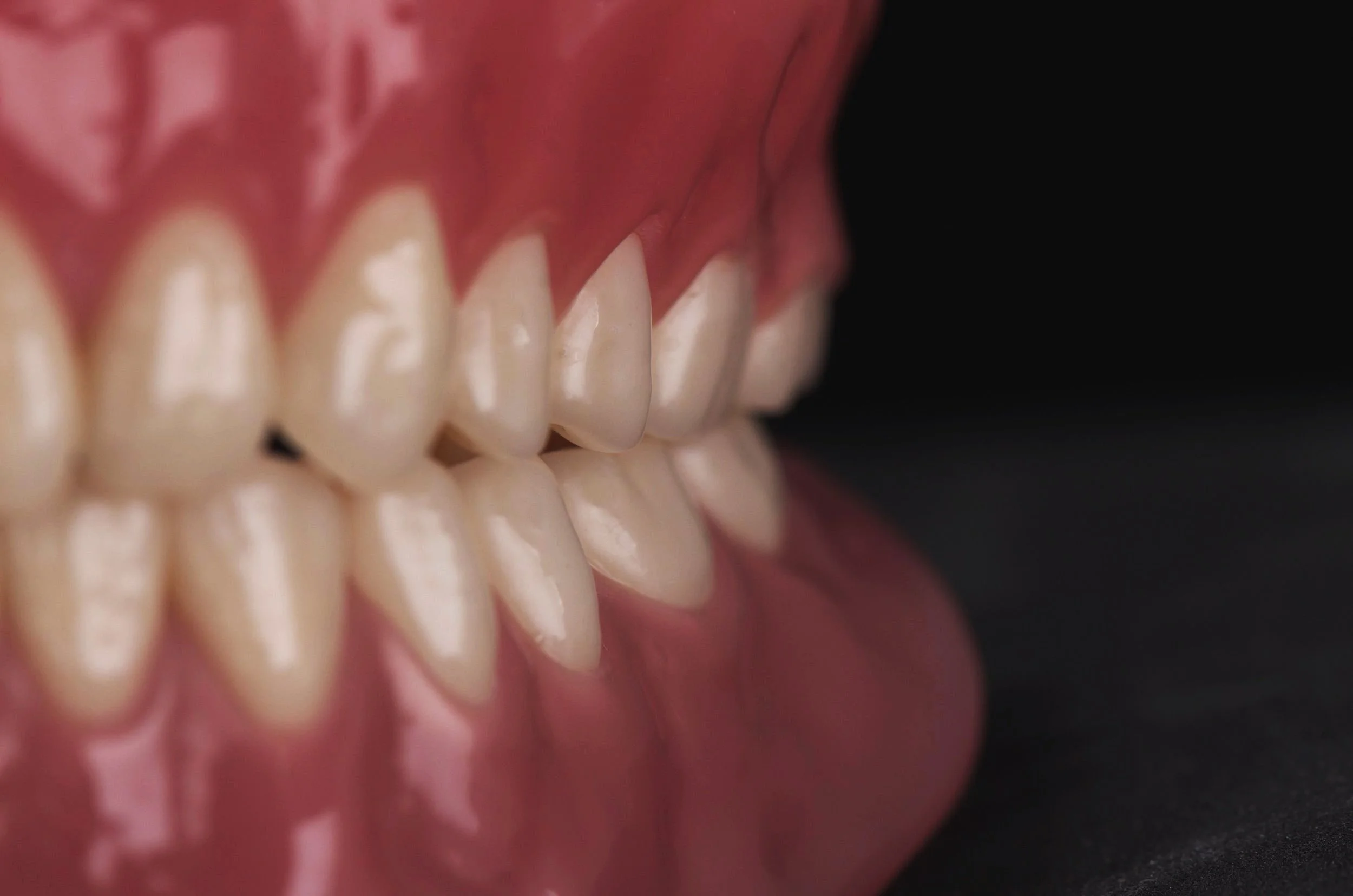 Walk In Denture Repairs Near Me Buderim & Bribie Island